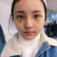 肥厚鼻尖矫正术风险大吗?想变美就这么难吗?