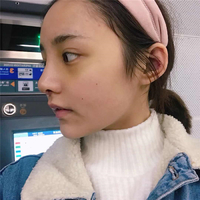 肥厚鼻尖矫正术风险大吗?想变美就这么难吗?