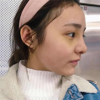 肥厚鼻尖矫正术风险大吗?想变美就这么难吗?
