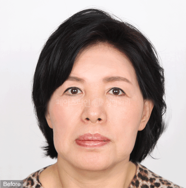 acmetea抗衰专用：再不抗衰，真的就来不及了！