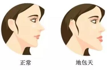珠海九龙口腔医院答：儿童牙齿还没换完不能做牙齿矫正？