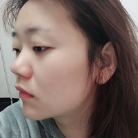 光乳化去眼袋多少钱?以我的能力能做吗?