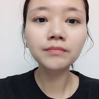 光乳化去眼袋多少钱?以我的能力能做吗?