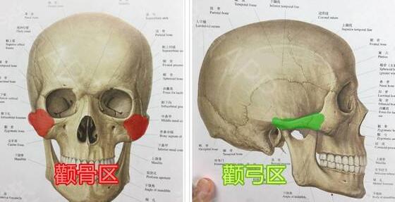 颧骨颧弓整形会下垂吗?