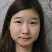 黄子龙切开双眼皮真人前后对比：35天逆袭成为气质女王 width=