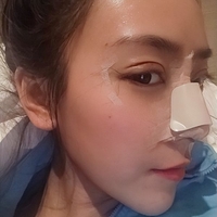 东田整形技术如何?就近选择东田整形靠谱吗?