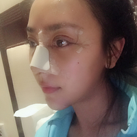 东田整形技术如何?就近选择东田整形靠谱吗?