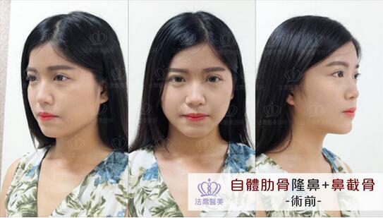 崔理允都经历了些什么，造就了现在的崔理允？！
