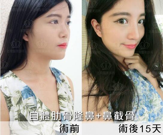 崔理允都经历了些什么，造就了现在的崔理允？！