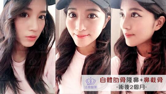 崔理允都经历了些什么，造就了现在的崔理允？！