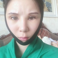米亚整形眼部手术整形果如何?我也想拥有了自己的大眼睛!