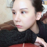 米亚整形眼部手术整形果如何?我也想拥有了自己的大眼睛!