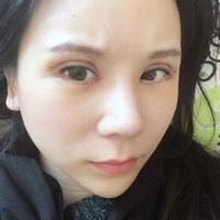 米亚整形眼部手术整形果如何?我也想拥有了自己的大眼睛!