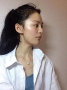 刘世铭面部吸脂瘦脸56天对比照片：瘦脸笔记 width=