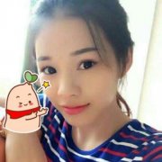 温州加美医院肋软骨隆鼻前后对比案例：1-67天的变化 width=