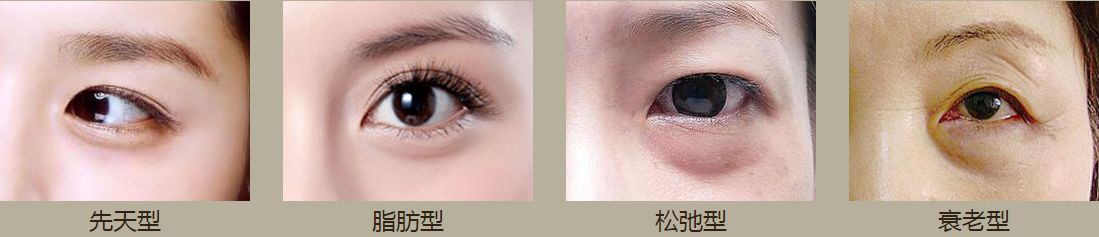 电波拉皮去眼袋果长久吗?