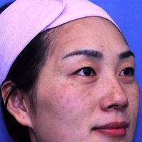 王-者风范祛斑果如何?能让我这黄褐斑消失吗?