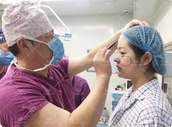杭州华山连天美刘军自体脂肪填充额头和面颊+双眼皮案例记录~