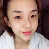 全切去皮去脂双眼皮恢复全过程分享，两个月后的我美美哒~~~