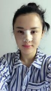 大连王艇隆鼻前后对比图：68天真人案例日记~ width=