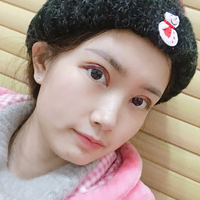 盛宗顺医生做双眼皮怎么样?个人案例分享~