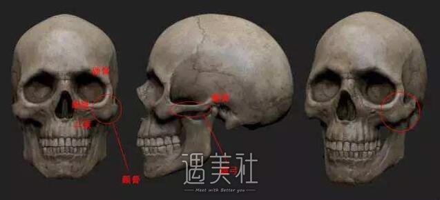 磨腮削骨恢复期到底有多长?怎样才能想要的果?