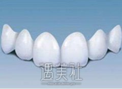 美容冠的价格是多少，影响价格的因素有哪些了? width=