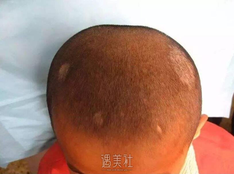张国基医生技术怎么样?个人简介展示!