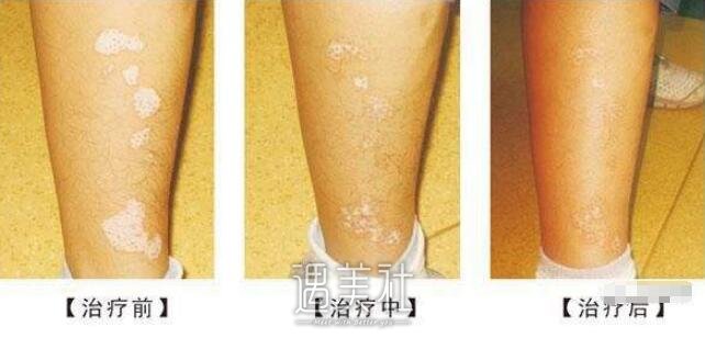 张国基医生技术怎么样?个人简介展示!