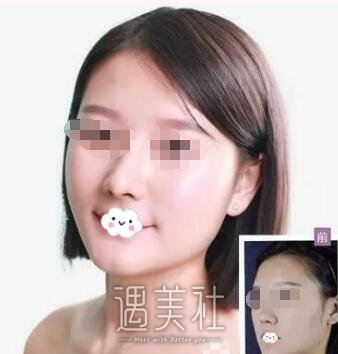 王英俊医生的技术有保障吗?个人小档案分享~