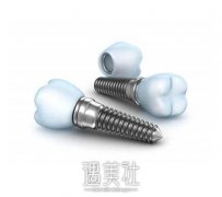满口牙种植多少钱?为什么会有天价种植牙 width=