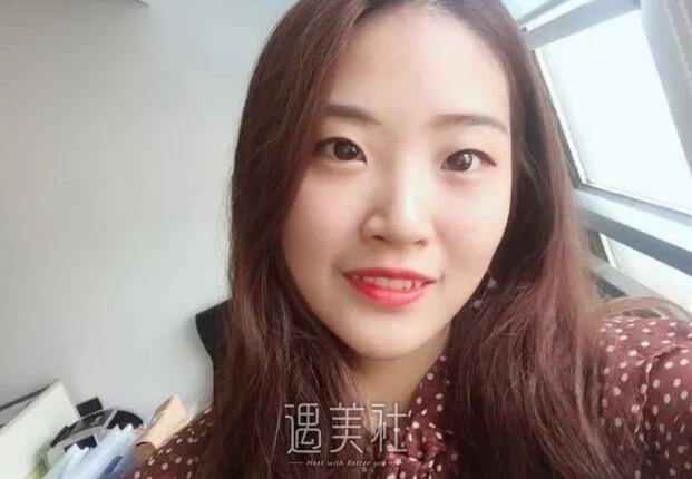 百嘉丽侯亚杰做双眼皮怎么样?真实案例展现其好技术!