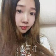 八大处马继光鼻部手术做的怎样?这篇案例很有说服力! width=