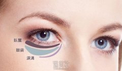 吸脂去眼袋有副作用吗？整理下吸脂去眼袋的副作用~ width=