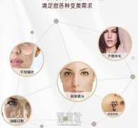 成都oe光子嫩肤价格大概多少？想了解下喃！ width=
