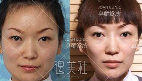 卓彦整形医院