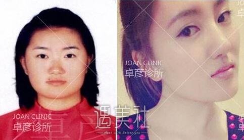 卓彦整形医院