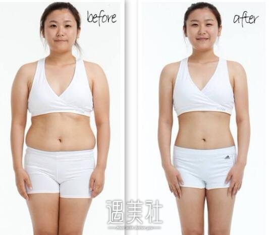 激光溶脂减肥对人体有没危害|激光溶脂减肥优缺点~