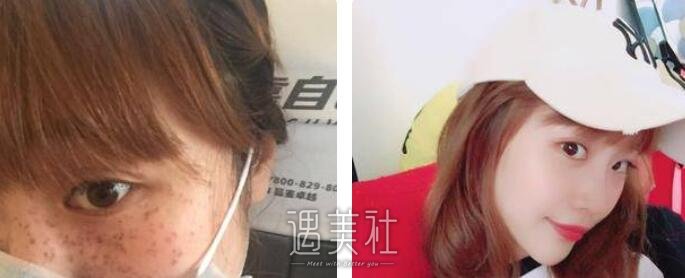 林洁瑜