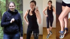 什么是负压吸脂减肥?负压吸脂减肥详细介绍公布~ width=