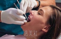 种植牙的收费是怎样的？种植牙价格表更新上线~ width=