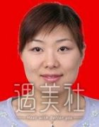 北京协和朱琳双眼皮案例，摇身拥有大眼睛~ width=
