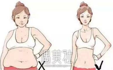 韩式共振吸脂减肥