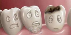 宁波补牙齿大概多少钱?有必要去口腔门诊吗? width=