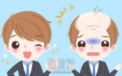 杭州植发价格大概是多少？掉发掉得我忒难受啊！ width=