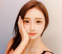 上海肥胖下颌角整容大概要多少钱？跟我来看看！ width=