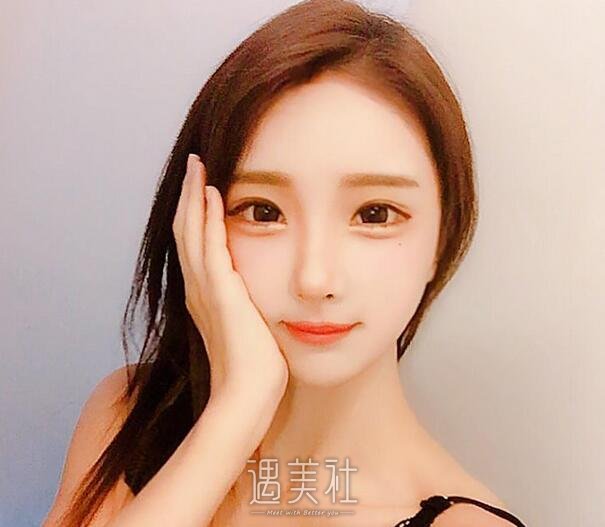 肥胖下颌角整容