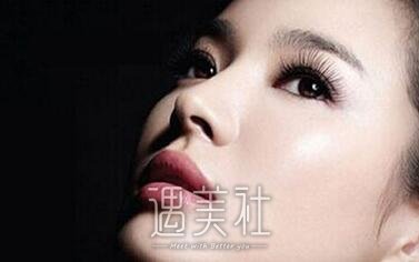 韩式鼻翼缩小