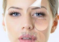 光乳化去眼袋多少钱？制约因素小编罗列出来~ width=