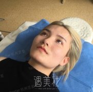 自从做了像素射频除皱，瞬间回到那个青葱岁月! width=